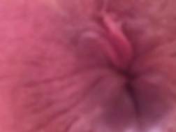 anus closeup