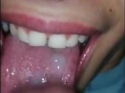 oral boca leche