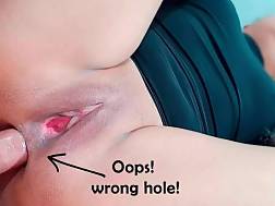 hole anal